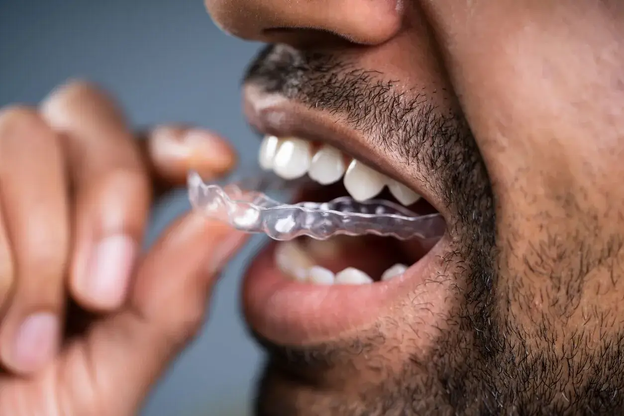 Patient fitting a clear aligner tray