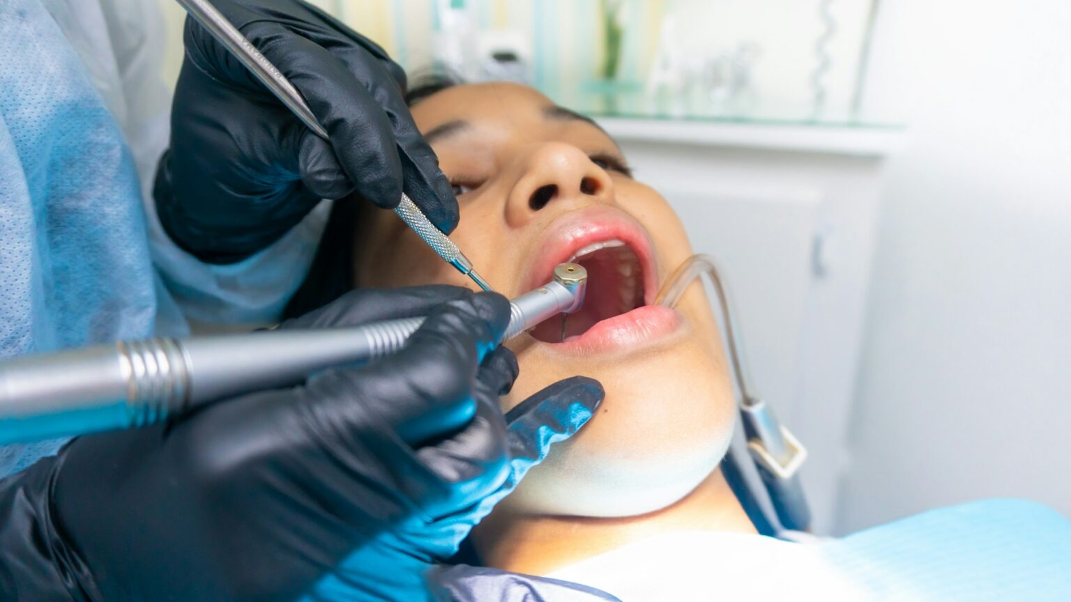 Dentist performing a professional dental cleaning